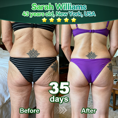 𝐹𝑙𝑜𝑟𝑎𝑣𝑦𝑛𝑒® 𝑆𝑡𝑒𝑚 𝐶𝑒𝑙𝑙 & 𝐶𝑜𝑙𝑙𝑎𝑔𝑒𝑛 𝑃𝑒𝑝𝑡𝑖𝑑𝑒 𝑂𝑟𝑎𝑙 𝐷𝑟𝑜𝑝𝑠 （𝐿𝑖𝑓𝑡 & 𝐹𝑖𝑟𝑚 𝑆𝑎𝑔𝑔𝑖𝑛𝑔 𝑆𝑘𝑖𝑛 & 𝑅𝑒𝑑𝑢𝑐𝑒 𝑊𝑟𝑖𝑛𝑘𝑙𝑒 𝐹𝑜𝑟𝑚𝑎𝑡𝑖𝑜𝑛）-CU