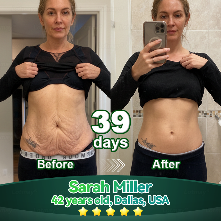 𝐹𝑙𝑜𝑟𝑎𝑣𝑦𝑛𝑒® 𝑆𝑡𝑒𝑚 𝐶𝑒𝑙𝑙 & 𝐶𝑜𝑙𝑙𝑎𝑔𝑒𝑛 𝑃𝑒𝑝𝑡𝑖𝑑𝑒 𝑂𝑟𝑎𝑙 𝐷𝑟𝑜𝑝𝑠 （𝐿𝑖𝑓𝑡 & 𝐹𝑖𝑟𝑚 𝑆𝑎𝑔𝑔𝑖𝑛𝑔 𝑆𝑘𝑖𝑛 & 𝑅𝑒𝑑𝑢𝑐𝑒 𝑊𝑟𝑖𝑛𝑘𝑙𝑒 𝐹𝑜𝑟𝑚𝑎𝑡𝑖𝑜𝑛）-CU