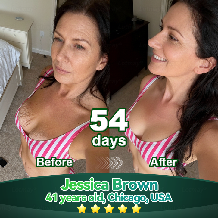 𝐹𝑙𝑜𝑟𝑎𝑣𝑦𝑛𝑒® 𝑆𝑡𝑒𝑚 𝐶𝑒𝑙𝑙 & 𝐶𝑜𝑙𝑙𝑎𝑔𝑒𝑛 𝑃𝑒𝑝𝑡𝑖𝑑𝑒 𝑂𝑟𝑎𝑙 𝐷𝑟𝑜𝑝𝑠 （𝐿𝑖𝑓𝑡 & 𝐹𝑖𝑟𝑚 𝑆𝑎𝑔𝑔𝑖𝑛𝑔 𝑆𝑘𝑖𝑛 & 𝑅𝑒𝑑𝑢𝑐𝑒 𝑊𝑟𝑖𝑛𝑘𝑙𝑒 𝐹𝑜𝑟𝑚𝑎𝑡𝑖𝑜𝑛）-CU