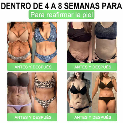 𝑻𝒊𝒆𝒏𝒅𝒂 𝑶𝒇𝒊𝒄𝒊𝒂𝒍 | 𝑭𝒍𝒐𝒓𝒂𝒗𝒚𝒏𝒆® 𝑮𝑳𝑷-1 8 𝒆𝒏 1 𝑺𝒐𝒍𝒖𝒄𝒊𝒐́𝒏 𝑶𝒓𝒂𝒍 𝑺𝒍𝒊𝒎 & 𝑯𝒆𝒂𝒍𝒕𝒉𝒚 🌿 𝑼𝒏𝒂 𝒅𝒐𝒔𝒊𝒔 𝒂𝒍 𝒅𝒊́𝒂, 𝒓𝒆𝒔𝒖𝒍𝒕𝒂𝒅𝒐𝒔 𝒆𝒏 7 𝒅𝒊́𝒂𝒔 ✅ 𝑪𝒐𝒏𝒕𝒓𝒐𝒍 𝒅𝒆 𝒐𝒃𝒆𝒔𝒊𝒅𝒂𝒅, 𝒅𝒊𝒂𝒃𝒆𝒕𝒆𝒔, 𝒔𝒂𝒍𝒖𝒅 𝒊𝒏𝒕𝒆𝒔𝒕𝒊𝒏𝒂𝒍 𝒚 𝒂𝒓𝒕𝒊𝒄𝒖𝒍𝒂𝒓, 𝒎𝒆𝒋𝒐𝒓𝒂 𝒆𝒍 𝒄𝒐𝒓𝒂𝒛𝒐́𝒏, 𝒍𝒂 𝒑𝒊𝒆𝒍 𝒚 𝒍𝒂 𝒆𝒏𝒆𝒓𝒈𝒊́𝒂.-MX