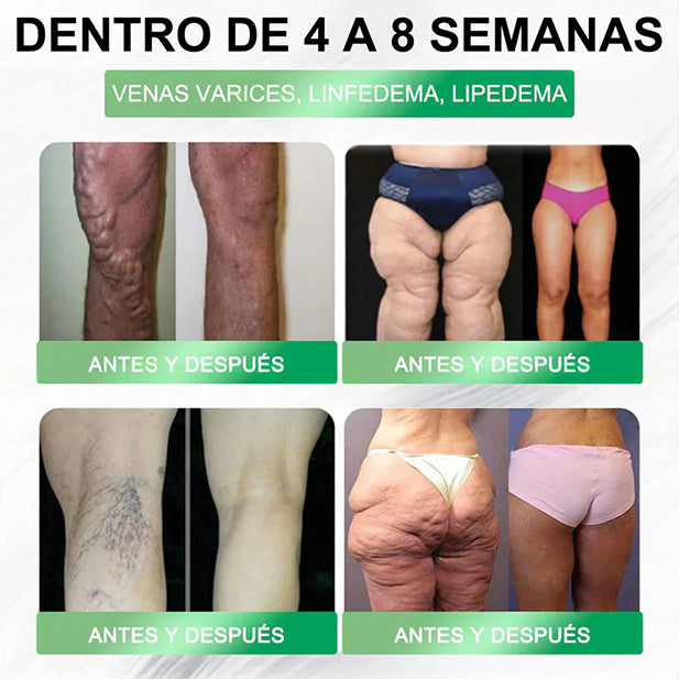 𝑻𝒊𝒆𝒏𝒅𝒂 𝑶𝒇𝒊𝒄𝒊𝒂𝒍 | 𝑭𝒍𝒐𝒓𝒂𝒗𝒚𝒏𝒆® 𝑮𝑳𝑷-1 8 𝒆𝒏 1 𝑺𝒐𝒍𝒖𝒄𝒊𝒐́𝒏 𝑶𝒓𝒂𝒍 𝑺𝒍𝒊𝒎 & 𝑯𝒆𝒂𝒍𝒕𝒉𝒚 🌿 𝑼𝒏𝒂 𝒅𝒐𝒔𝒊𝒔 𝒂𝒍 𝒅𝒊́𝒂, 𝒓𝒆𝒔𝒖𝒍𝒕𝒂𝒅𝒐𝒔 𝒆𝒏 7 𝒅𝒊́𝒂𝒔 ✅ 𝑪𝒐𝒏𝒕𝒓𝒐𝒍 𝒅𝒆 𝒐𝒃𝒆𝒔𝒊𝒅𝒂𝒅, 𝒅𝒊𝒂𝒃𝒆𝒕𝒆𝒔, 𝒔𝒂𝒍𝒖𝒅 𝒊𝒏𝒕𝒆𝒔𝒕𝒊𝒏𝒂𝒍 𝒚 𝒂𝒓𝒕𝒊𝒄𝒖𝒍𝒂𝒓, 𝒎𝒆𝒋𝒐𝒓𝒂 𝒆𝒍 𝒄𝒐𝒓𝒂𝒛𝒐́𝒏, 𝒍𝒂 𝒑𝒊𝒆𝒍 𝒚 𝒍𝒂 𝒆𝒏𝒆𝒓𝒈𝒊́𝒂.-MX