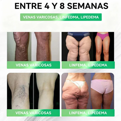 𝑽𝒊𝒕𝒂𝒍𝒖𝒏𝒂𝒉𝒆𝒂𝒍𝒕𝒉® 𝑮𝑳𝑷-1 8 𝒆𝒏 1 𝑭𝒊𝒕 & 𝑽𝒊𝒕𝒂𝒍 (𝒔𝒐𝒍𝒐 𝒖𝒏𝒂 𝒗𝒆𝒛 𝒂𝒍 𝒅𝒊́𝒂, 𝒄𝒂𝒎𝒃𝒊𝒐𝒔 𝒗𝒊𝒔𝒊𝒃𝒍𝒆𝒔 𝒆𝒏 7 𝒅𝒊́𝒂𝒔) √ 𝑷𝒂𝒓𝒂 𝒐𝒃𝒆𝒔𝒊𝒅𝒂𝒅, 𝒔𝒂𝒍𝒖𝒅 𝒄𝒂𝒓𝒅𝒊𝒐𝒗𝒂𝒔𝒄𝒖𝒍𝒂𝒓, 𝒅𝒊𝒂𝒃𝒆𝒕𝒆𝒔, 𝒂𝒑𝒏𝒆𝒂 𝒅𝒆𝒍 𝒔𝒖𝒆𝒏̃𝒐, 𝒔𝒂𝒍𝒖𝒅 𝒊𝒏𝒕𝒆𝒔𝒕𝒊𝒏𝒂𝒍, 𝒑𝒓𝒐𝒃𝒍𝒆𝒎𝒂𝒔 𝒂𝒓𝒕𝒊𝒄𝒖𝒍𝒂𝒓𝒆𝒔 𝒚 𝒎𝒂́𝒔-YH