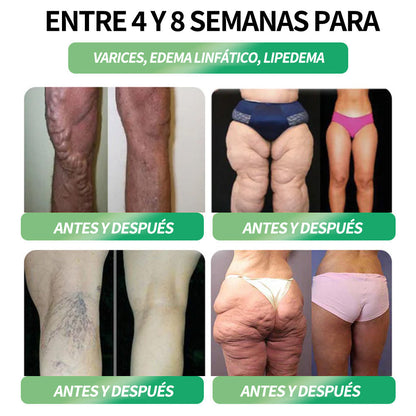 𝑭𝒍𝒐𝒓𝒂𝒗𝒚𝒏𝒆® 𝐓𝐢𝐞𝐧𝐝𝐚 𝐎𝐟𝐢𝐜𝐢𝐚𝐥 | 𝑭𝒍𝒐𝒓𝒂𝒗𝒚𝒏𝒆® 𝐆𝐋𝐏-𝟏 𝐒𝐨𝐥𝐮𝐜𝐢𝐨́𝐧 𝐎𝐫𝐚𝐥 𝐝𝐞 𝐒𝐚𝐥𝐮𝐝 𝐒𝐞𝐢𝐬 𝐞𝐧 𝐔𝐧𝐨 (𝐒𝐨́𝐥𝐨 𝐮𝐧𝐚 𝐯𝐞𝐳 𝐚𝐥 𝐝𝐢́𝐚, 𝐜𝐚𝐦𝐛𝐢𝐨𝐬 𝐯𝐢𝐬𝐢𝐛𝐥𝐞𝐬 𝐞𝐧 𝟕 𝐝𝐢́𝐚𝐬) ✅ 𝐏𝐚𝐫𝐚 𝐥𝐚 𝐨𝐛𝐞𝐬𝐢𝐝𝐚𝐝, 𝐬𝐚𝐥𝐮𝐝 𝐜𝐚𝐫𝐝𝐢𝐨𝐯𝐚𝐬𝐜𝐮𝐥𝐚𝐫, 𝐝𝐢𝐚𝐛𝐞𝐭𝐞𝐬, 𝐚𝐩𝐧𝐞𝐚 𝐝𝐞𝐥 𝐬𝐮𝐞𝐧̃𝐨, 𝐬𝐚𝐥𝐮𝐝 𝐝𝐢𝐠𝐞𝐬𝐭𝐢𝐯𝐚, 𝐩𝐫𝐨𝐛𝐥𝐞𝐦𝐚𝐬 𝐚𝐫𝐭𝐢𝐜𝐮𝐥𝐚𝐫𝐞𝐬 𝐲 𝐦𝐚́𝐬-𝐂𝐉𝐘